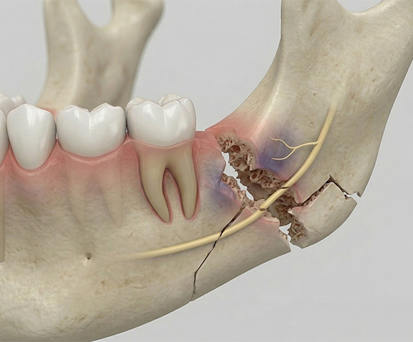 Traumatología Maxilofacial