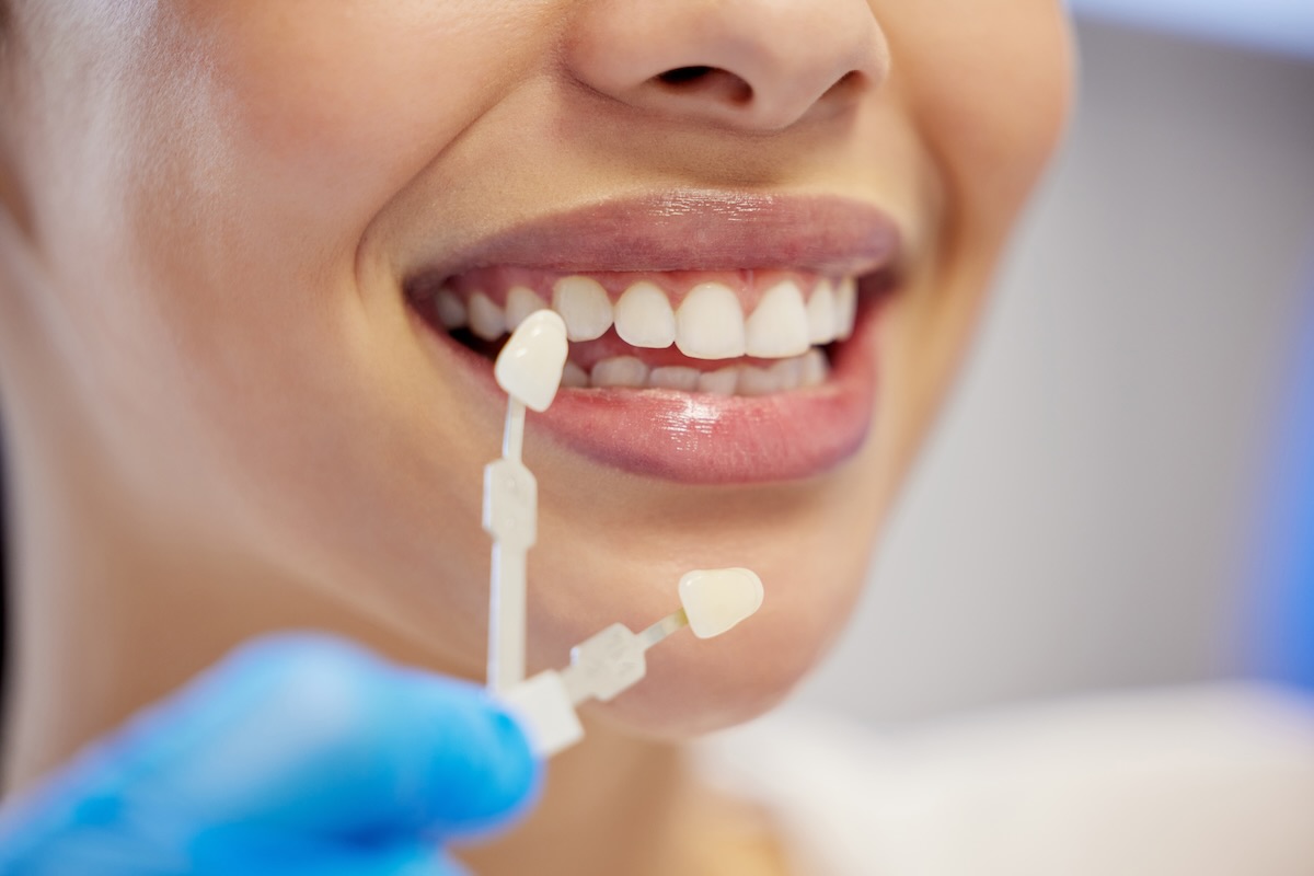 Cosmética Dental en Guyaquil, Ecuador, en Dental Med Corp.