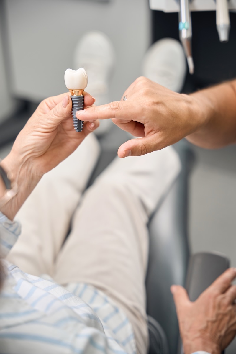 Implantes individuales