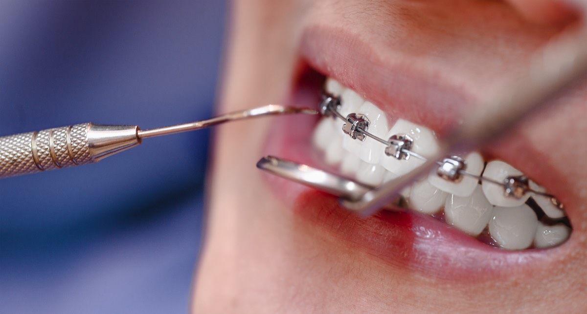 Ortodoncia en guayaquil, ecuador, en Dental medical corp