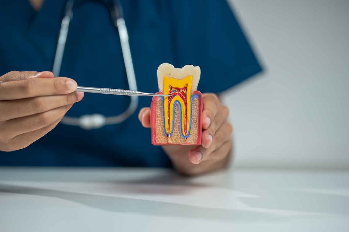Periodoncia